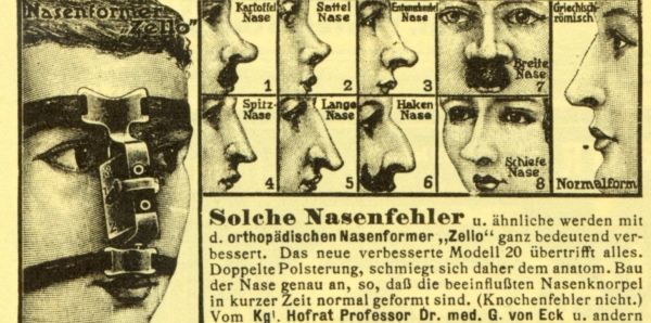 Roman nose on women