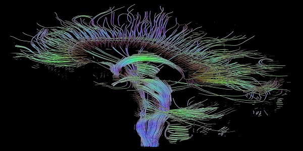 An image of neural pathways in the brain taken using diffusion tensor imaging