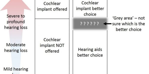 Diagram showing the grey area, where people with severe hearing loss greater than 70decibels may possibly benefit from a cochlear implant but are not offered one as the evidence isn't clear about the benefits.