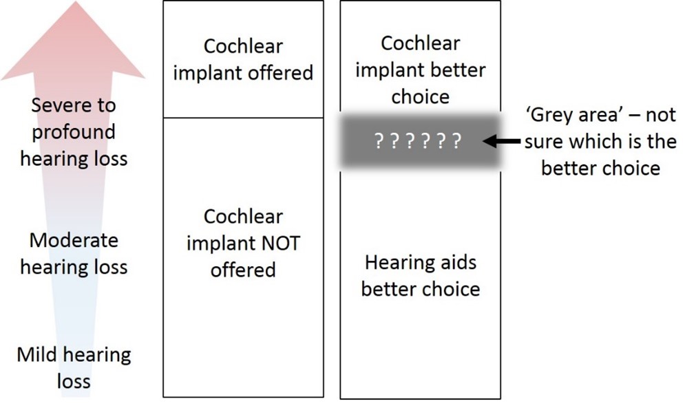 Diagram showing the grey area, where people with severe hearing loss greater than 70decibels may possibly benefit from a cochlear implant but are not offered one as the evidence isn't clear about the benefits. 