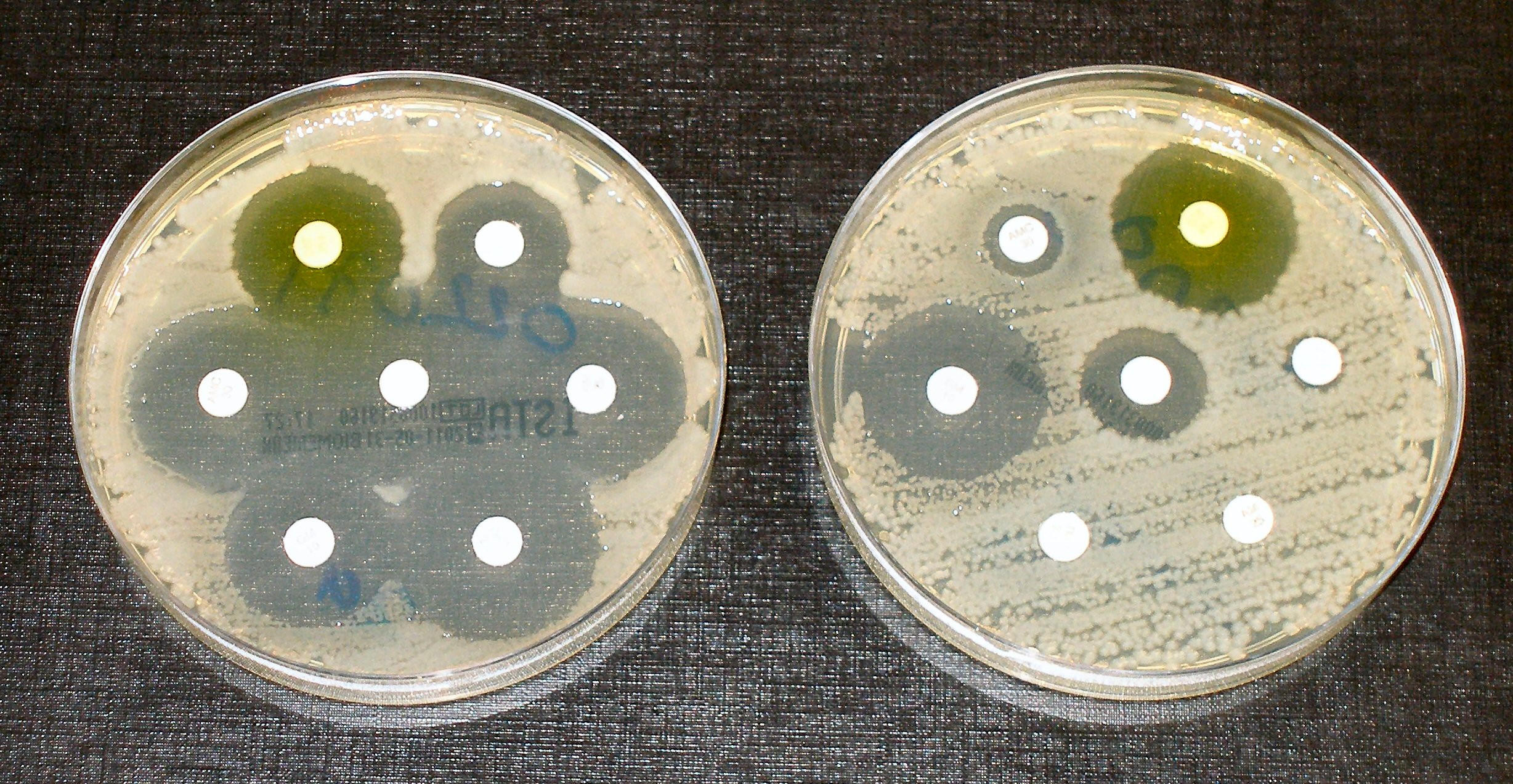 Antibiotic Resistant Infections In The News Making Science Public