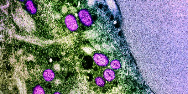 Microscopic image of the mpox virus, green and purple blobs