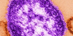 Measles virus (science.kqed.org)