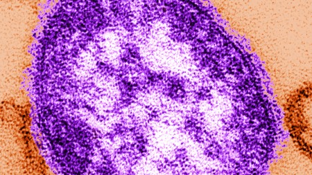 Measles virus (science.kqed.org)
