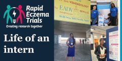 Rapid Eczema Trials Life of an Intern