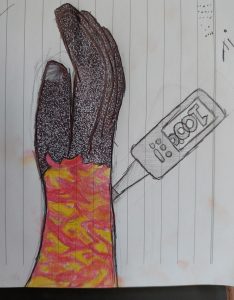 A drawing of an arm and a thermometer